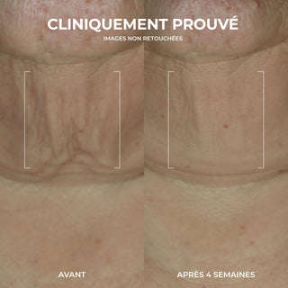 RoC Skincare product image - SKU BeforeAfter, professional anti-aging skincare treatment