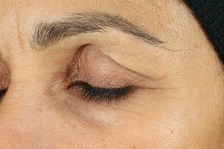 RoC Skincare product image - SKU Before, professional anti-aging skincare treatment