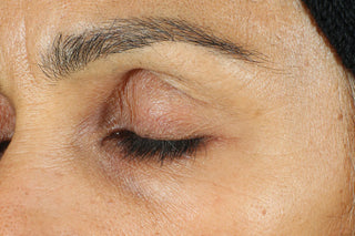 RoC Skincare product image - SKU Before, professional anti-aging skincare treatment