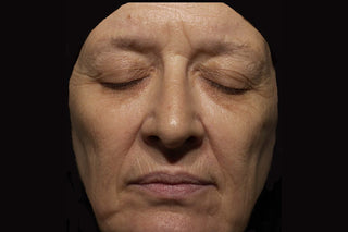 RoC Skincare product image - SKU Before, professional anti-aging skincare treatment