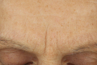 RoC Skincare product image - SKU Before, professional anti-aging skincare treatment
