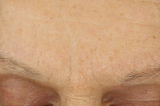 RoC Skincare product image - SKU Before, professional anti-aging skincare treatment