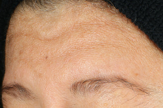 RoC Skincare product image - SKU Before, professional anti-aging skincare treatment