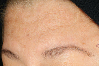 RoC Skincare product image - SKU Before, professional anti-aging skincare treatment