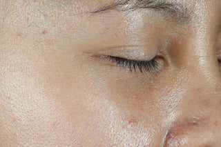Close-up of a person's closed eye and cheek, showing natural skin texture, pores, and slight blemishes.