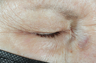 RoC Skincare product image - SKU Before, professional anti-aging skincare treatment