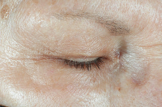 RoC Skincare product image - SKU Before, professional anti-aging skincare treatment