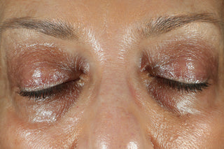 RoC Skincare product image - SKU Before, professional anti-aging skincare treatment