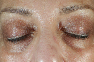 RoC Skincare product image - SKU Before, professional anti-aging skincare treatment