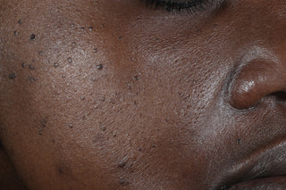 RoC Skincare product image - SKU Before, professional anti-aging skincare treatment