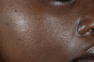 RoC Skincare product image - SKU Before, professional anti-aging skincare treatment
