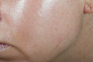 RoC Skincare product image - SKU Before, professional anti-aging skincare treatment