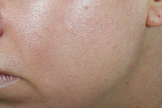RoC Skincare product image - SKU Before, professional anti-aging skincare treatment