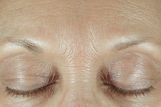 RoC Skincare product image - SKU Before, professional anti-aging skincare treatment