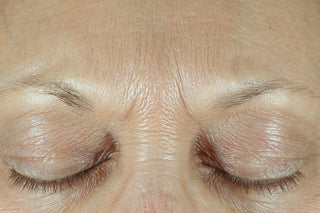 RoC Skincare product image - SKU Before, professional anti-aging skincare treatment