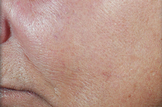 RoC Skincare product image - SKU DC, professional anti-aging skincare treatment