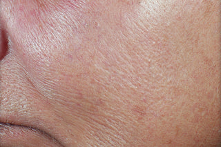 RoC Skincare product image - SKU DC, professional anti-aging skincare treatment