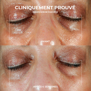 RoC Skincare product image - SKU PAGESPRODUITS5126, professional anti-aging skincare treatment