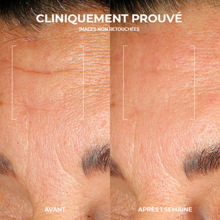 RoC Skincare product image - SKU PAGESPRODUITS5132, professional anti-aging skincare treatment