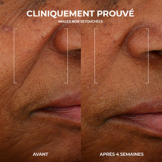 RoC Skincare product image - SKU PAGESPRODUITS529, professional anti-aging skincare treatment