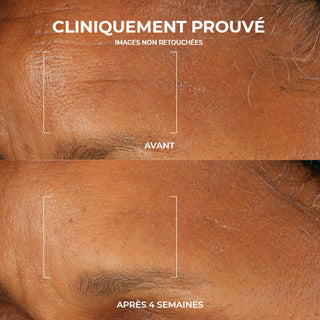 RoC Skincare product image - SKU PAGESPRODUITS539, professional anti-aging skincare treatment