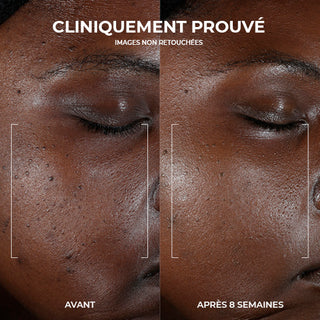 RoC Skincare product image - SKU PAGESPRODUITS555, professional anti-aging skincare treatment