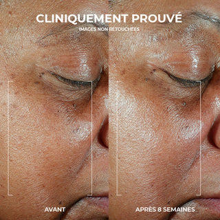RoC Skincare product image - SKU PAGESPRODUITS561, professional anti-aging skincare treatment