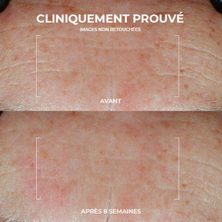 RoC Skincare product image - SKU PAGES, professional anti-aging skincare treatment