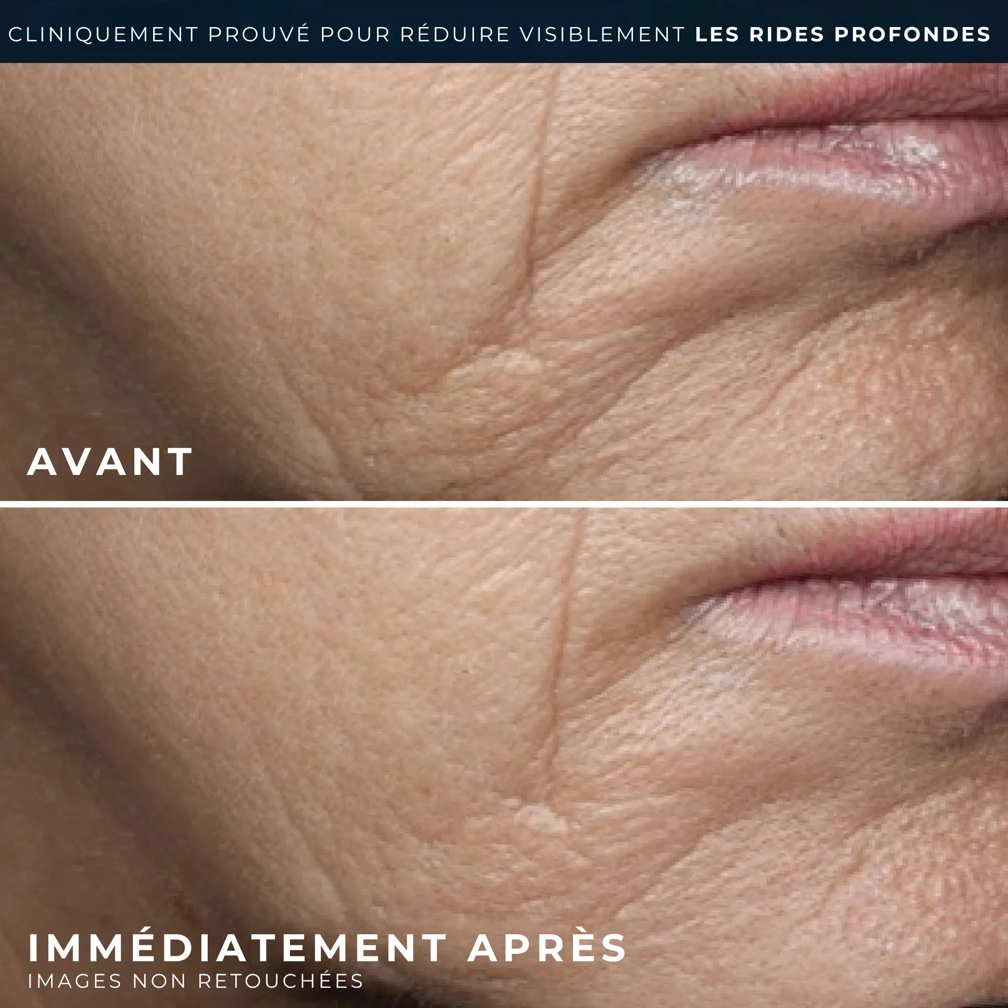 Avis Crème Riche Correctrice Rides - Active Repair : notes des membres Beauté Test Avis Crème Riche Correctrice Rides - Active Repair : notes des membres Beauté Test