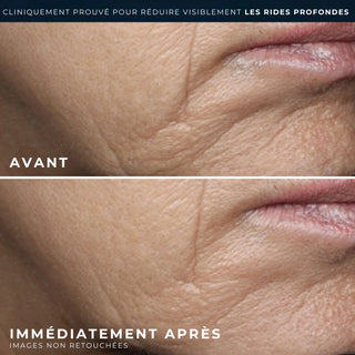 RETINOL CORREXION® Rides profondes Crème Riche