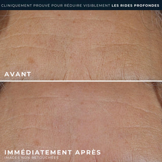 RETINOL CORREXION® Rides profondes Crème Riche
