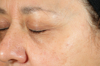 RoC Skincare product image - SKU Before, professional anti-aging skincare treatment