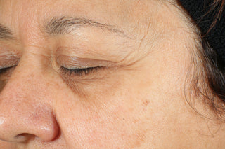 RoC Skincare product image - SKU Before, professional anti-aging skincare treatment