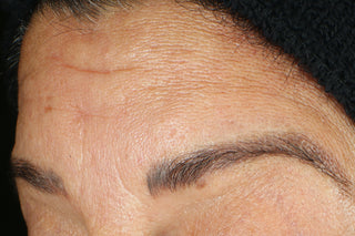 RoC Skincare product image - SKU Before, professional anti-aging skincare treatment