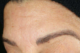 RoC Skincare product image - SKU Before, professional anti-aging skincare treatment