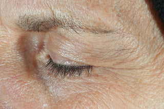 RoC Skincare product image - SKU Before, professional anti-aging skincare treatment