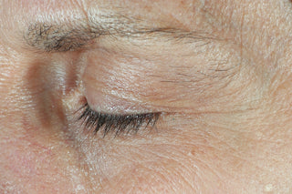 RoC Skincare product image - SKU Before, professional anti-aging skincare treatment