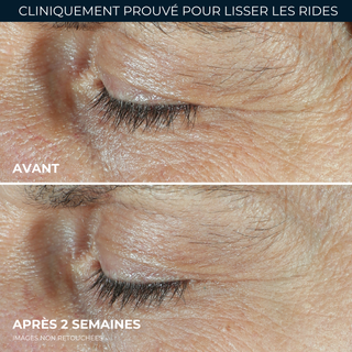 DERM CORREXION® Soin Duo contour des yeux