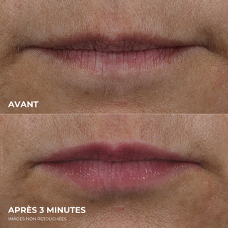 DERM CORREXION® Lip Volumizer