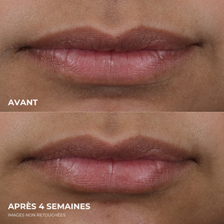 DERM CORREXION® Lip Volumizer