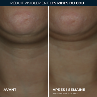 DERM CORREXION® Crème Contour