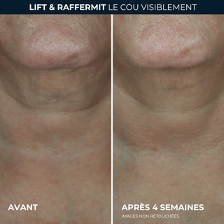 DERM CORREXION® Crème Contour