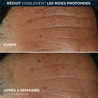 DERM CORREXION® Sérum Combler+Traiter