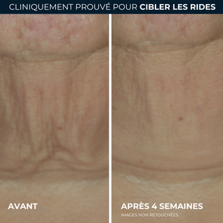 DERM CORREXION® SOINS CIBLÉS Sérum stick raffermissant