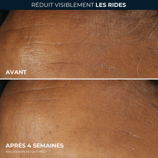 Hydratant quotidien Correction Rides Rides profondes