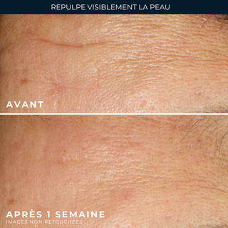 Capsules Serum hydrater e& repulper