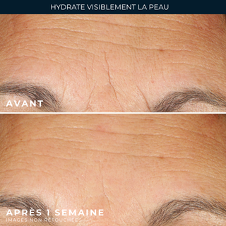 Capsules Serum hydrater e& repulper