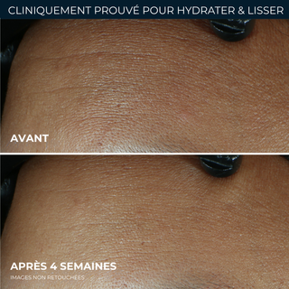 Crème hydratation maximale soin lissant rétinol pour rides