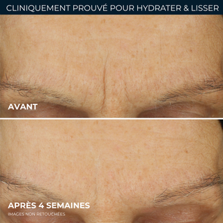 Crème hydratation maximale soin lissant rétinol pour rides