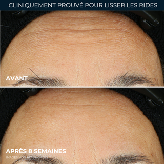 Serum capsules soin lissant rétinol pour rides